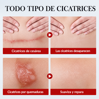 Crema Reparadora de Cicatrices SADOER